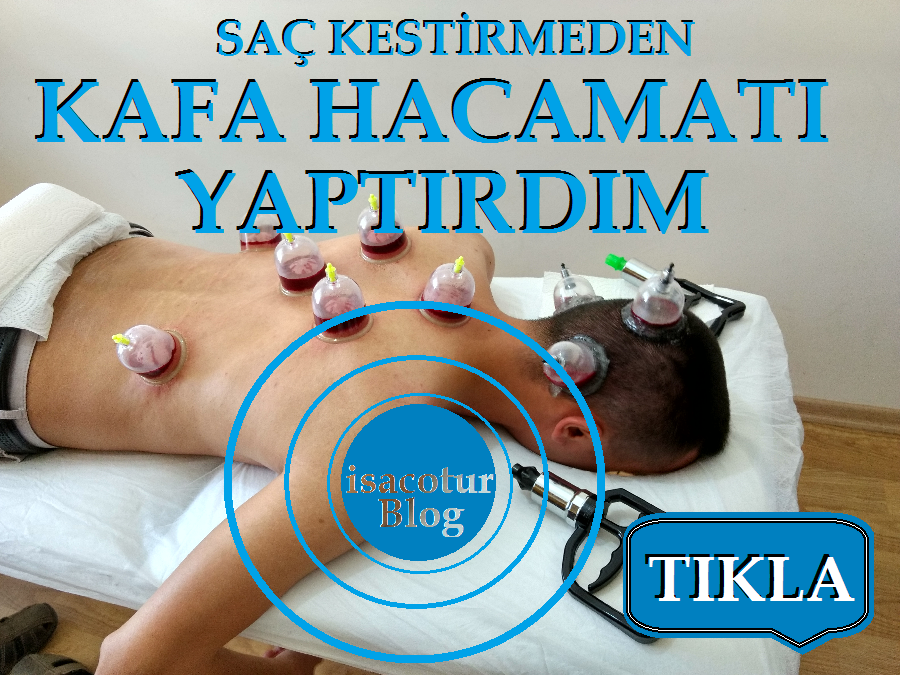 Saç Kesmeden Kafadan Hacamat Yaptırdım